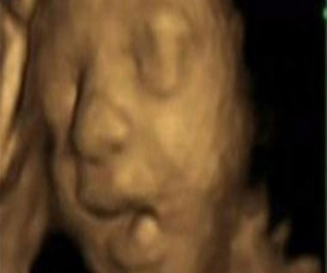   مصر اليوم - الشاي الأخضر يؤثر سلبيًا على الأجنة